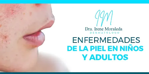 Imagen 2 del perfil de Dra. Irene Moraleda Cuesta