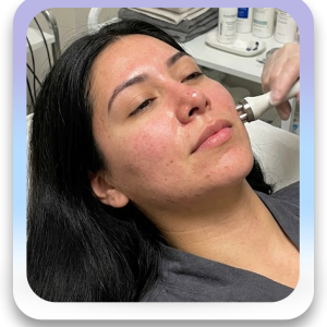 Renovación Facial