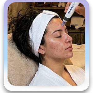 Renovación Facial Premium