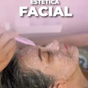 Dermapen rico en plasma