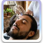 Dermapen rico en plasma