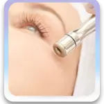 Microdermoabrasión