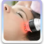 Radiofrecuencia Facial