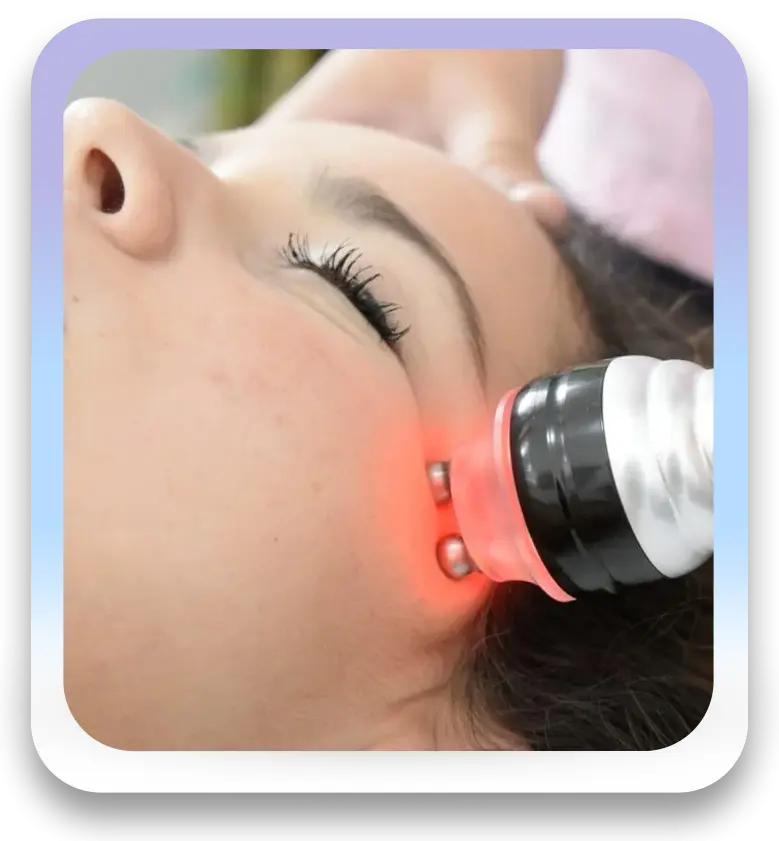 Radiofrecuencia facial