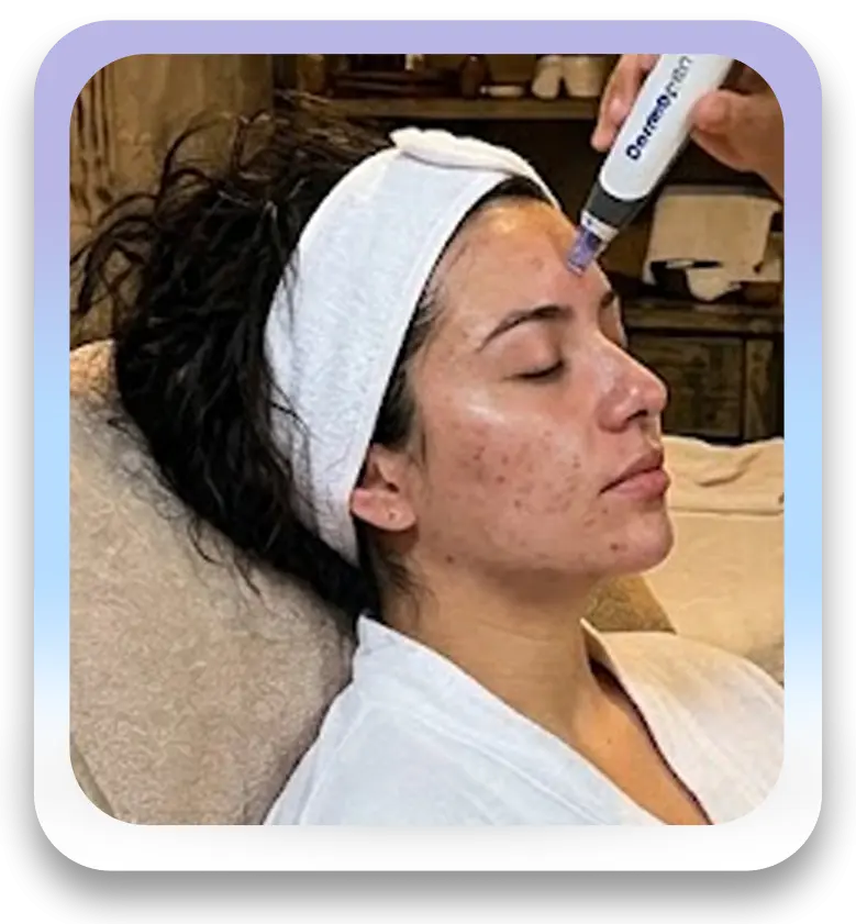 Renovación facial premium